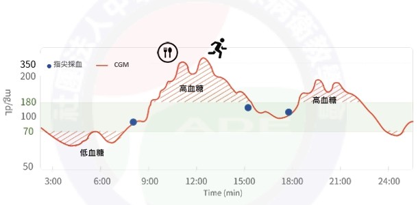 連續血糖監測 APP 畫面