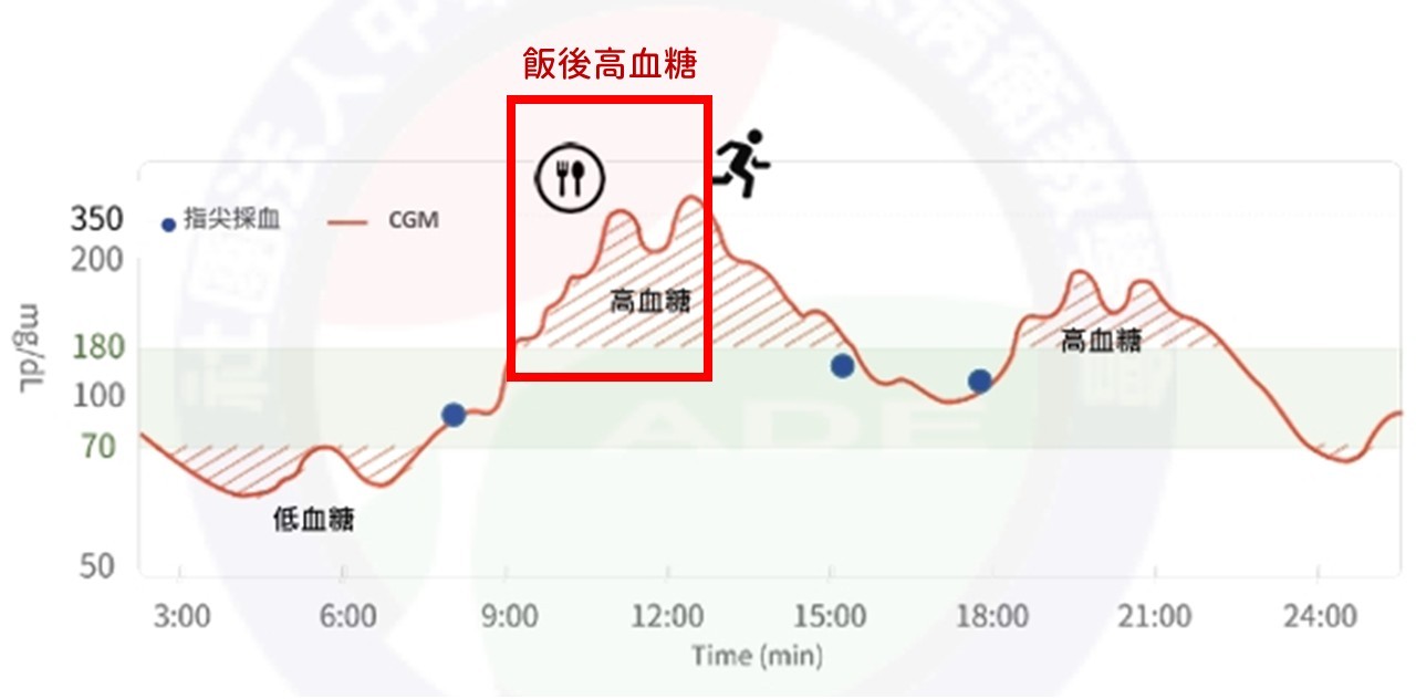 餐後血糖變化