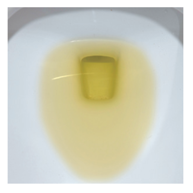 清腸良好示意圖